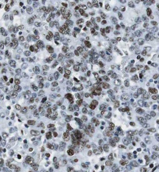 RPAIN Antibody - BSA Free