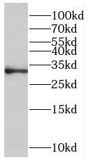 ROGDI Antibody - BSA Free