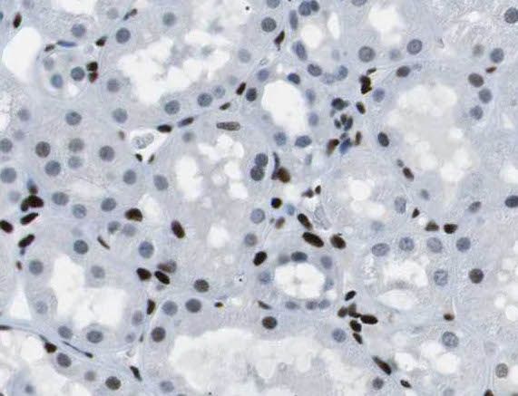ROGDI Antibody - BSA Free
