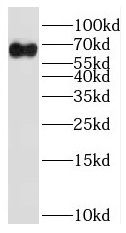 RNPC3 Antibody - BSA Free