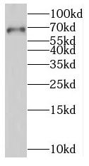 RNGTT Antibody - BSA Free