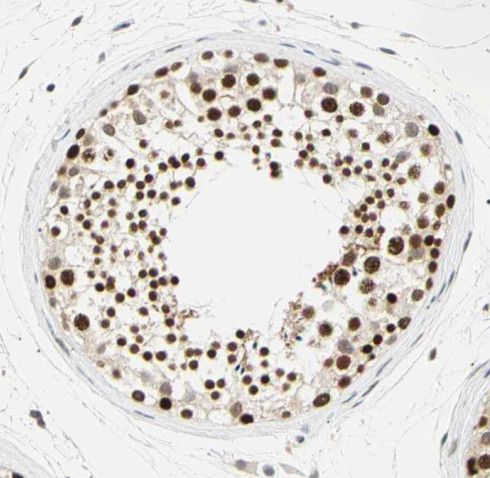 RNF17 Antibody - BSA Free