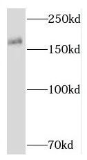 RNF17 Antibody - BSA Free