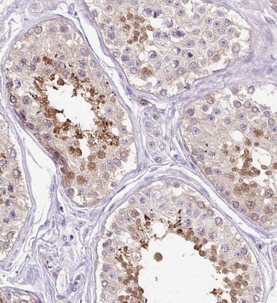 RNF151 Antibody - BSA Free