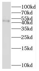 RNF150 Antibody - BSA Free