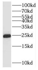 RNF125 Antibody - BSA Free