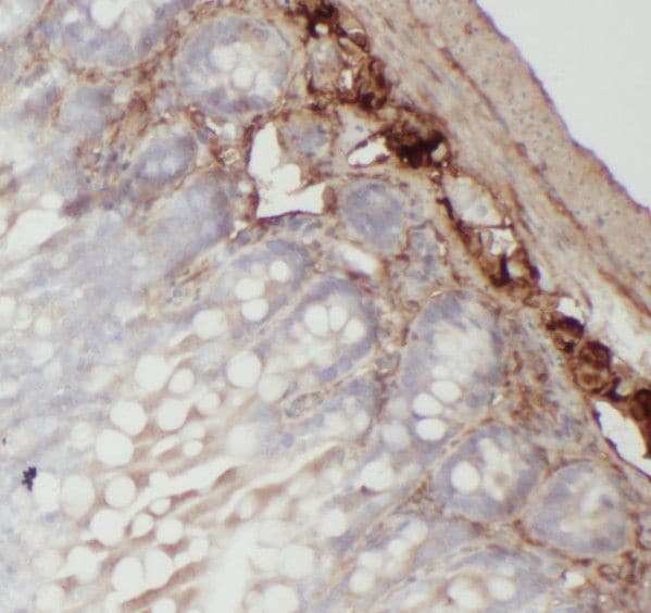 RMND5B Antibody - BSA Free