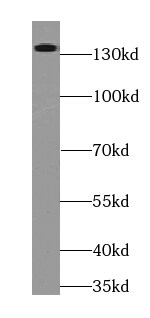 RIMS2 Antibody - BSA Free