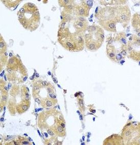 RhoB Antibody - BSA Free