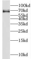 RGS7 Antibody - BSA Free