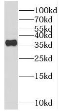 REM2 Antibody - BSA Free