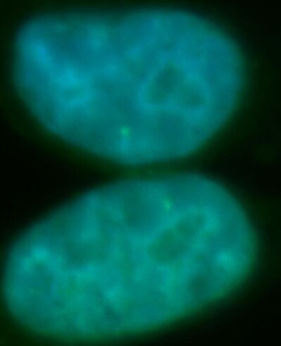 RECQL5 Antibody - BSA Free