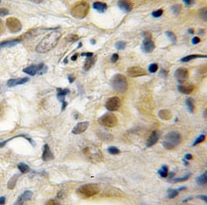 RECQL5 Antibody - BSA Free