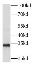 RDM1 Antibody - BSA Free