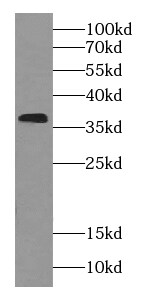 RDH14 Antibody - BSA Free