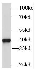 RDH10 Antibody - BSA Free