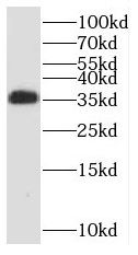 RCBTB1 Antibody - BSA Free