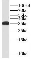 RCAN2 Antibody - BSA Free