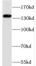 RBP3 Antibody - BSA Free