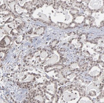 RBM6 Antibody - BSA Free