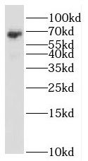 RBM47 Antibody - BSA Free