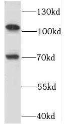 RBM15B Antibody - BSA Free