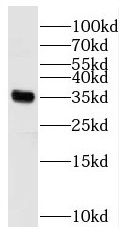 RBM11 Antibody - BSA Free