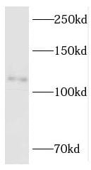 RBM10 Antibody - BSA Free