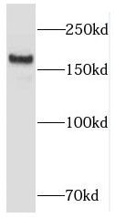RB1CC1 Antibody - BSA Free