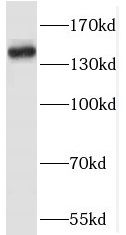 RASAL2 Antibody - BSA Free