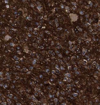 RAP1GDS1 Antibody - BSA Free