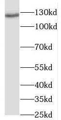 RANBP6 Antibody - BSA Free