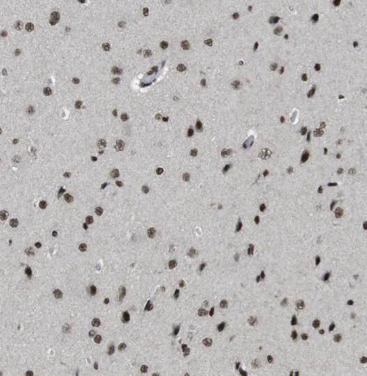 RANBP3L Antibody - BSA Free
