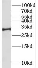 RALYL Antibody - BSA Free