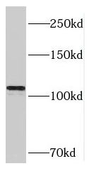 RAI14 Antibody - BSA Free