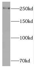 RAI1 Antibody - BSA Free