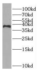 RAD51AP1 Antibody - BSA Free