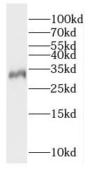 Rad1 Antibody - BSA Free