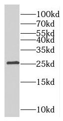 RABL3 Antibody - BSA Free