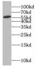 Rabex5 Antibody - BSA Free