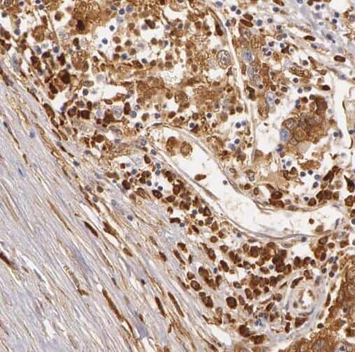 RABGAP1L Antibody - BSA Free
