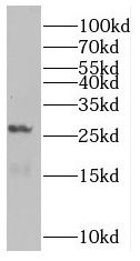 Rab5b Antibody - BSA Free