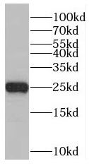 RAB41 Antibody - BSA Free