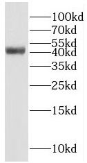 RAB3IL1 Antibody - BSA Free
