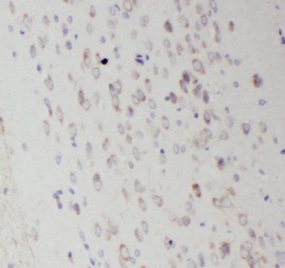 RAB35 Antibody - BSA Free