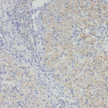 RAB34 Antibody - BSA Free