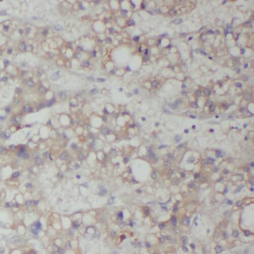 RAB14 Antibody - BSA Free