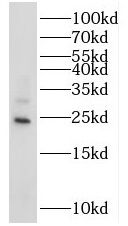 RAB14 Antibody - BSA Free