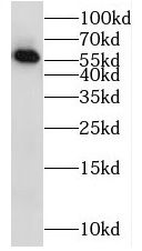 RAB11FIP2 Antibody - BSA Free