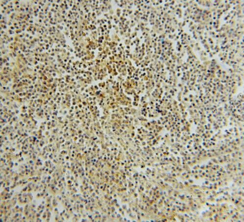 PTPN7 Antibody - BSA Free